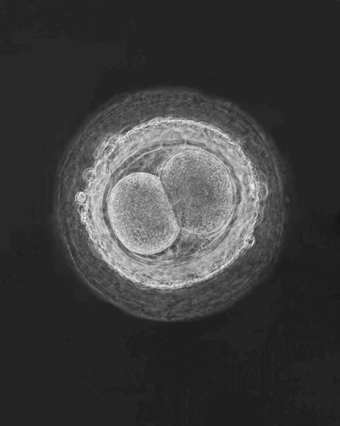  Fertilized egg cell, 1965 “A child is born”