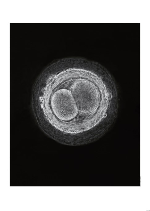  Fertilized egg cell, 1965 “A child is born”